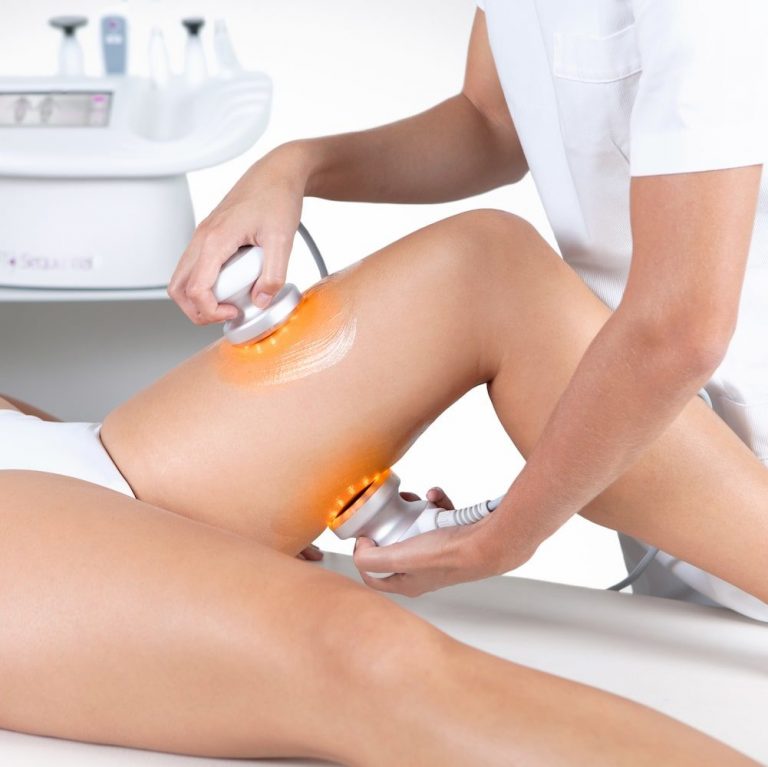 Exilis Elite radiofréquence et ultrasons à Montpellier
